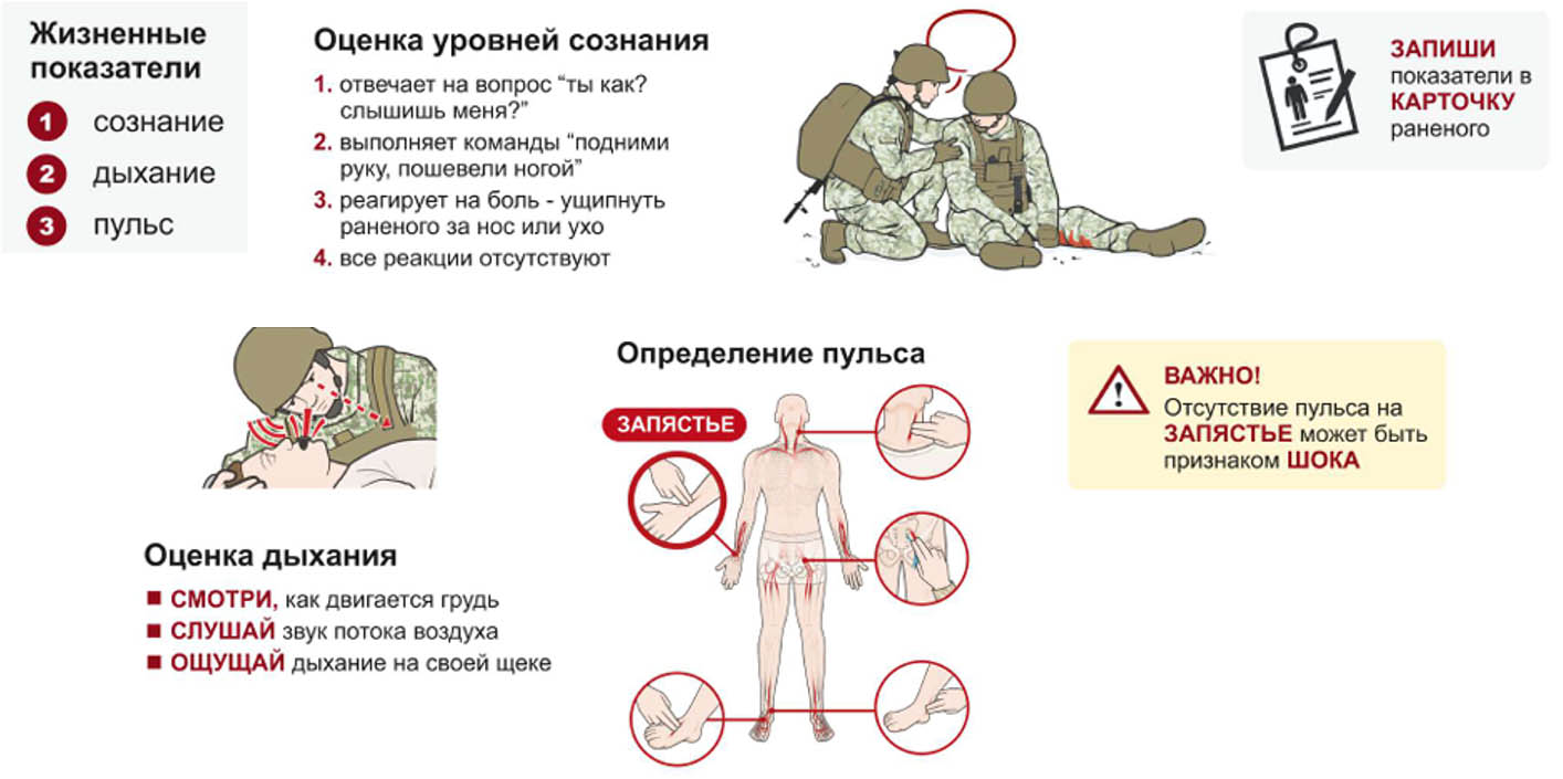 Иллюстрация: оценка жизненных показателей — сознание, дыхание, пульс