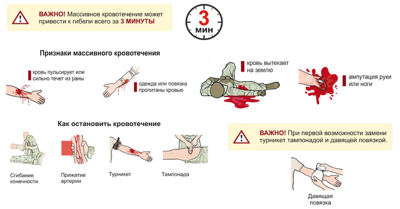 Иллюстрация: признаки массивного кровотечения и способы остановки